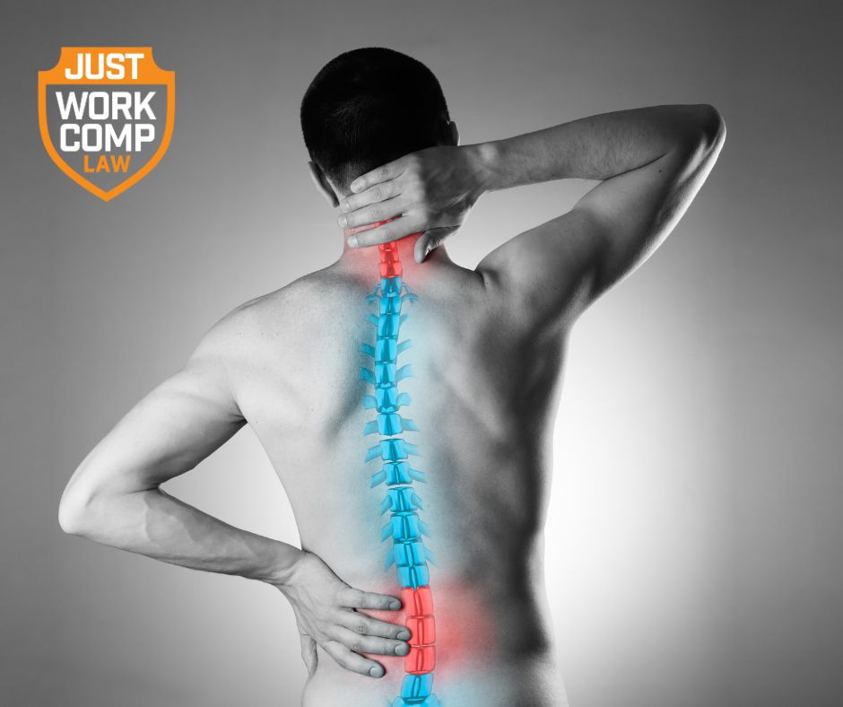 Understanding Workers' Comp Settlements for L4-L5-S1 and Lumbar Radiculopathy Injuries